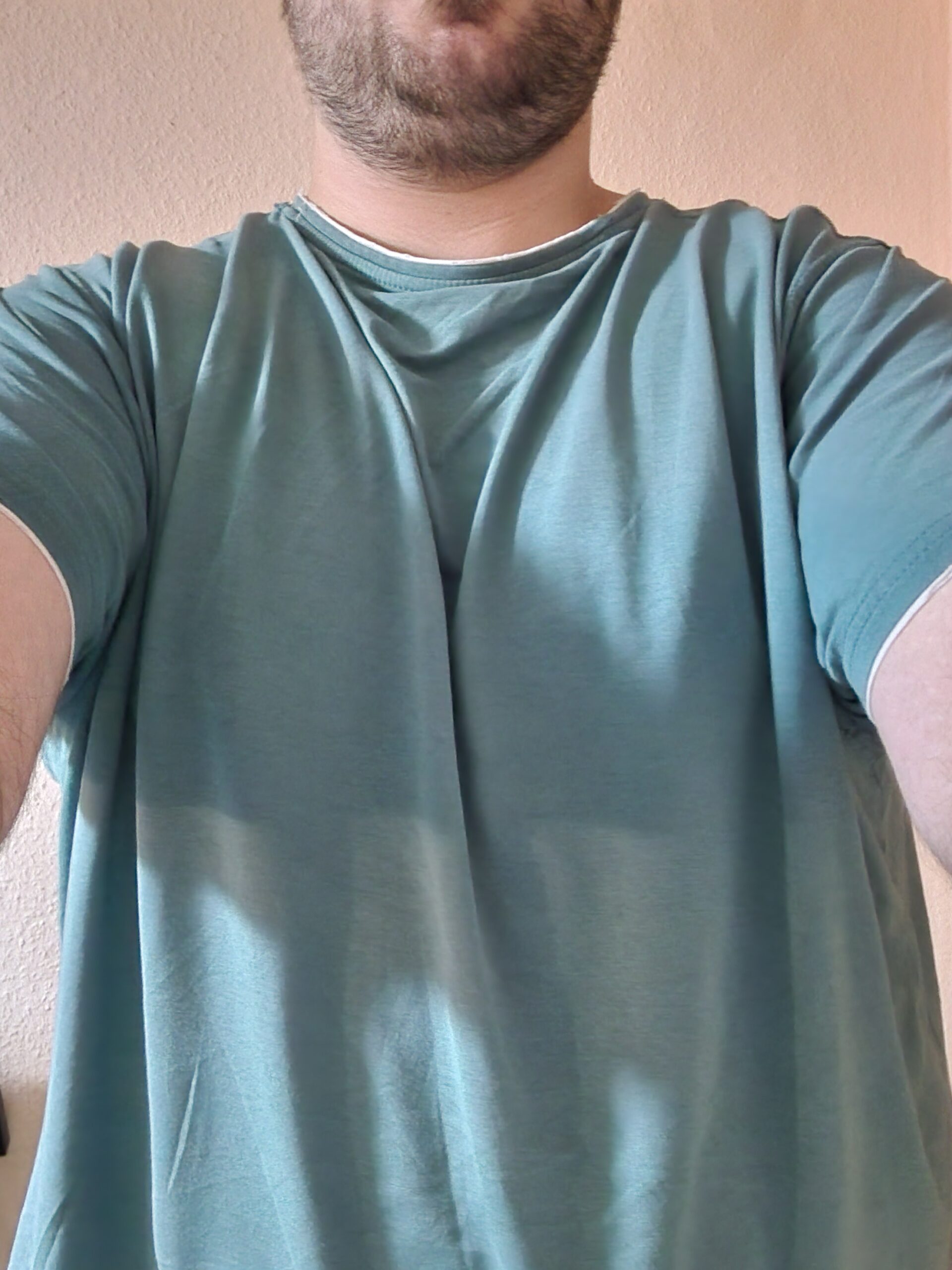 1000056151